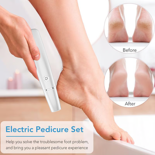 🔥Mother's Day Hot Sale 50%✨Electric Feet Callus Remover⚡